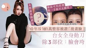 整容合集