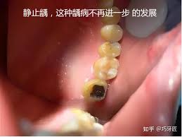 牙匠合集